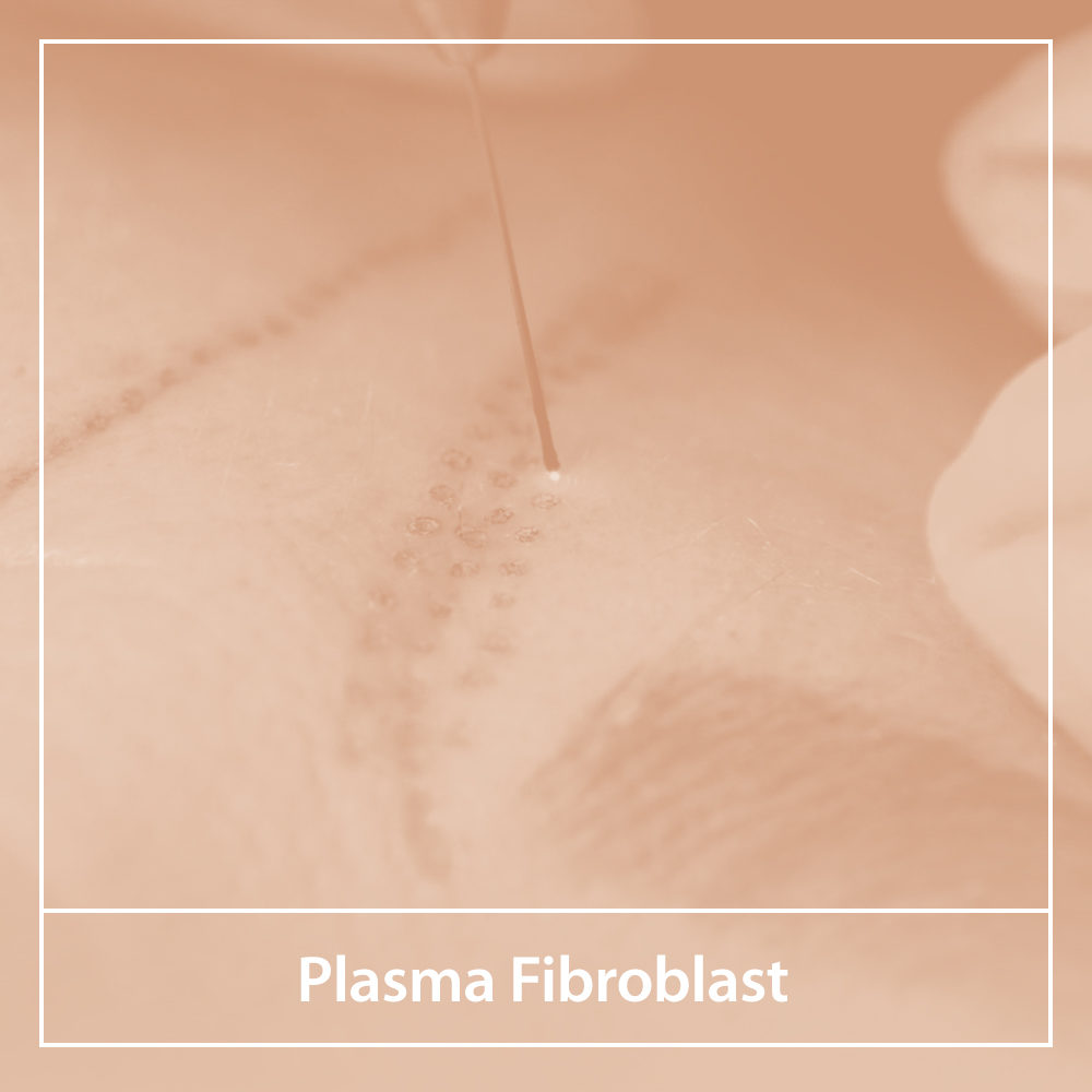 Plasma Fibroplast