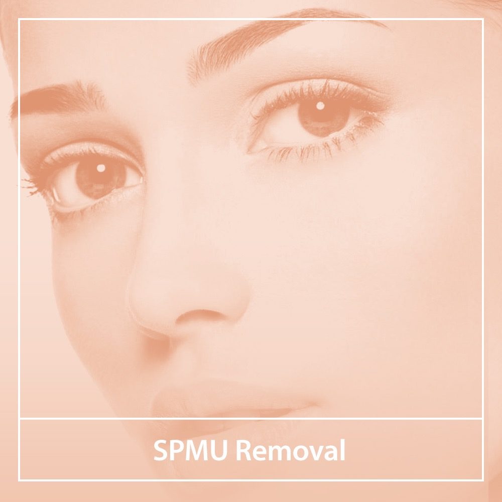 SPMU Removal